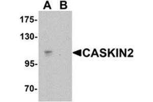 Western blot analysis of CASKIN2 in Hela cell lysate with CASKIN2 Antibody  at 1 ug/mL in (A) the absence and (B) the presence of blocking peptide.