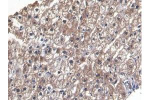 Detection of LEP in Human Liver Tissue using Monoclonal Antibody to Leptin (LEP)