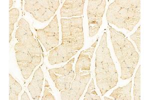 ABIN6255780 and ABIN6267335 at 1/100 staining Mouse muscle tissue by IHC-P. (IGF1R anticorps  (pTyr1165, pTyr1166))