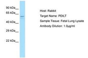 Image no. 1 for anti-Protein Disulfide Isomerase-Like, Testis Expressed (PDILT) (C-Term) antibody (ABIN6750221) (PDILT anticorps  (C-Term))