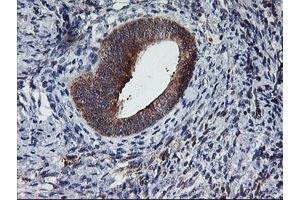 Image no. 2 for anti-Tubby Like Protein 3 (TULP3) antibody (ABIN1501583)