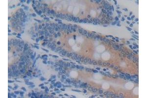 Detection of GSTA4 in Rat Colon Tissue using Polyclonal Antibody to Glutathione S Transferase A4 (GSTA4)