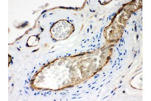 IHC(P): Human Placenta Tissue