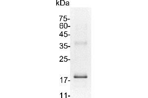 SDS-PAGE (SDS) image for Interleukin 7 (IL7) (Active) protein (His tag) (ABIN7884514)