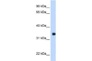 WB Suggested Anti-MLX Antibody Titration:  0. (MLX anticorps  (C-Term))