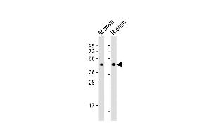 All lanes : Anti-CNP Antibody (C-Term) at 1:2000 dilution Lane 1: mouse brain lysates Lane 2: rat brain lysates Lysates/proteins at 20 μg per lane. (Cnpase anticorps  (AA 122-156))