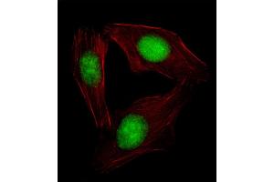 Fluorescent image of  cell stained with SREBF2 Antibody (Center) (ABIN654630 and ABIN2844326).