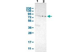 Western Blot analysis with PKP2 polyclonal antibody . (Plakophilin 2 anticorps  (AA 72-194))