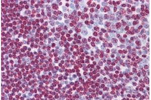 Human Tonsil: Formalin-Fixed, Paraffin-Embedded (FFPE)