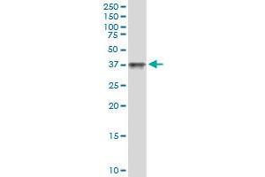 Immunoprecipitation of MAGEA11 transfected lysate using anti-MAGEA11 MaxPab rabbit polyclonal antibody and Protein A Magnetic Bead , and immunoblotted with MAGEA11 MaxPab mouse polyclonal antibody (B01) .