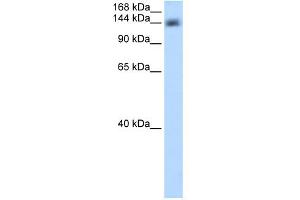 WB Suggested Anti-CPSF1 Antibody Titration:  0. (CPSF1 anticorps  (Middle Region))