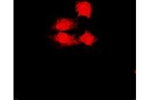 Immunofluorescent analysis of PHF17 staining in U2OS cells.