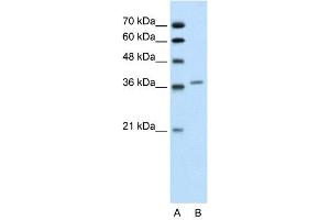 WB Suggested Anti-ALAD  Antibody Titration: 0. (ALAD anticorps  (Middle Region))
