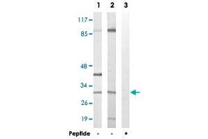 Western blot analysis of extracts from NIH/3T3 cells (Lane 1) and COLO 205 cells (Lane 2 and lane 3), using APOOL polyclonal antibody .