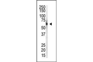 Image no. 1 for anti-Protein Inhibitor of Activated STAT, 4 (PIAS4) (N-Term) antibody (ABIN356770) (PIAS4 anticorps  (N-Term))