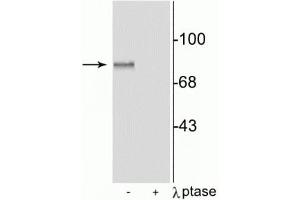 Western blot of rat brain lysate showing specific immunolabeling of the ~87 kDa MARCKS protein phosphorylated at Ser152,156, in the first lane (-). (MARCKS anticorps  (pSer152, pSer156))