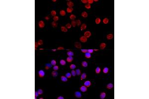 Immunofluorescence analysis of HeLa cells using CYP11B2 antibody (ABIN1679468, ABIN3015492, ABIN3015493 and ABIN6218533) at dilution of 1:100 (40x lens).
