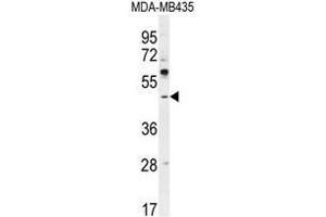 ATF4 Antibody (Center) western blot analysis in MDA-MB435 cell line lysates (35µg/lane). (ATF4 anticorps  (Middle Region))