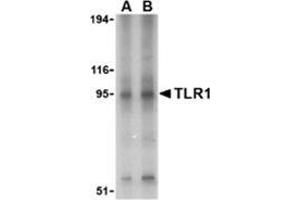 Western blot analysis of TLR1 in Daudi cell lysate with this product at (A) 1 and (B) 2 μg/ml. (TLR1 anticorps  (Center))