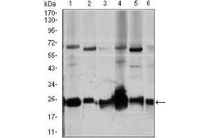 Western blot analysis using ARHGDIA mouse mAb against Jurkat (1), HeLa (2), NIH3T3 (3), C6 (4), K562 (5), and COS7 (6) cell lysate. (ARHGDIA anticorps  (AA 1-204))