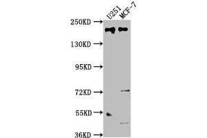 Western Blot Positive WB detected in: U251 whole cell lysate, MCF-7 whole cell lysate All lanes: UNC13B antibody at 1:2000 Secondary Goat polyclonal to rabbit IgG at 1/50000 dilution Predicted band size: 181, 183 kDa Observed band size: 181 kDa (UNC13B anticorps  (AA 12-215))
