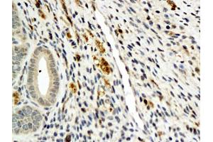 Formalin-fixed and paraffin embedded mouse ovary labeled with Anti-ANGPT3/ANG3/ANGPT4/ANG4 Polyclonal Antibody, Unconjugated (ABIN737466) followed by conjugation to the secondary antibody and DAB staining (Angiopoietin 4 anticorps  (AA 410-503))