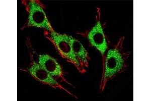 Fluorescent image of PC12 cells stained with Pink1 antibody. (PINK1 anticorps)
