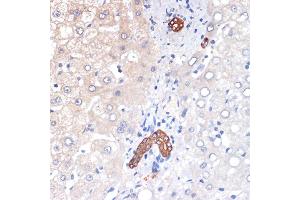 Immunohistochemistry of paraffin-embedded human liver using p53 DINP1 Rabbit mAb (ABIN7271097) at dilution of 1:100 (40x lens). (TP53INP1 anticorps)