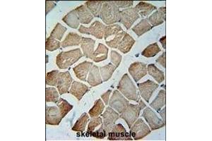 MTX2 Antibody (C-term) (ABIN654751 and ABIN2844433) immunohistochemistry analysis in formalin fixed and paraffin embedded human skeletal muscle followed by peroxidase conjugation of the secondary antibody and DAB staining. (MTX2 anticorps  (C-Term))