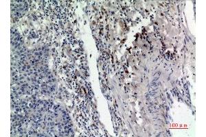 Immunohistochemistry (IHC) analysis of paraffin-embedded Human Lung, antibody was diluted at 1:100.