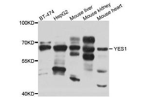 Western blot analysis of extracts of 293 cell line, using YES1 antibody. (YES1 anticorps  (AA 1-250))