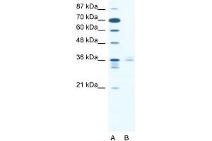 Human Jurkat; WB Suggested Anti-LHX3 Antibody. (LHX3 anticorps  (Middle Region))