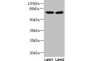Western blot All lanes: GALNT15 antibody at 5 μg/mL Lane 1: Mouse liver tissue Lane 2: Mouse kidney tissue Secondary Goat polyclonal to rabbit IgG at 1/10000 dilution Predicted band size: 74 kDa Observed band size: 74 kDa (GALNT14 anticorps  (AA 35-335))