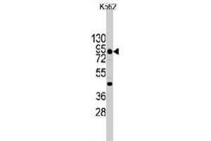 Western blot analysis of CDH3 (arrow) using rabbit CDH3 polyclonal antibody  in K-562 cell line lysates (35 ug/lane). (P-Cadherin anticorps  (C-Term))