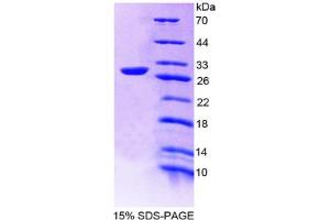 Image no. 1 for Mitogen-Activated Protein Kinase-Activated Protein Kinase 2 (MAPKAPK2) (AA 117-337) protein (His tag) (ABIN4988722) (MAPKAP Kinase 2 Protein (AA 117-337) (His tag))