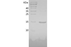 Western Blotting (WB) image for Leptin (LEP) (AA 22-167) protein (His tag) (ABIN7123742)