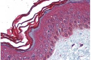 Human Skin (formalin-fixed, paraffin-embedded) stained with PERP antibody ABIN213966 at 5 ug/ml followed by biotinylated goat anti-rabbit IgG secondary antibody ABIN481713, alkaline phosphatase-streptavidin and chromogen. (PERP anticorps  (C-Term))