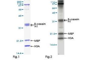 Kinase Activity Assay (KAA) image for CaM Kinase-Like Vesicle-Associated (CAMKV) (AA 1-501) protein (GST tag) (ABIN1347951)