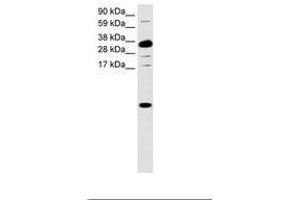 Image no. 1 for anti-Chemokine (C-X-C Motif) Ligand 1 (Melanoma Growth Stimulating Activity, Alpha) (CXCL1) (C-Term) antibody (ABIN6736034) (CXCL1 anticorps  (C-Term))