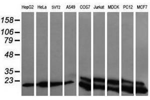 Image no. 9 for anti-Ubiquitin-Conjugating Enzyme E2G 2 (UBE2G2) antibody (ABIN1501631)