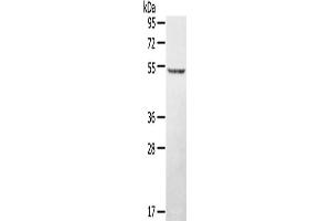 Western Blotting (WB) image for anti-serine/threonine/tyrosine Kinase 1 (STYK1) antibody (ABIN2427348) (STYK1 anticorps)