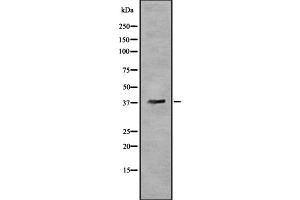 Western blot analysis OR5T3 using HeLa whole cell lysates (OR5T3 anticorps)