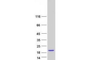 Validation with Western Blot