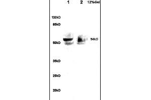 Lane 1: rat brain lysates Lane 2: human colon carcinoma lysates probed with Anti A1BG Polyclonal Antibody, Unconjugated  at 1:200 in 4˚C. (A1BG anticorps  (AA 301-400))