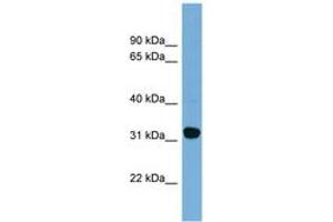 Image no. 1 for anti-Carbonyl Reductase 1 (CBR1) (AA 107-156) antibody (ABIN6744809) (CBR1 anticorps  (AA 107-156))