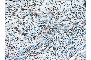 Immunohistochemical staining of paraffin-embedded Human liver tissue using anti-MTRF1L mouse monoclonal antibody. (MTRF1L anticorps)