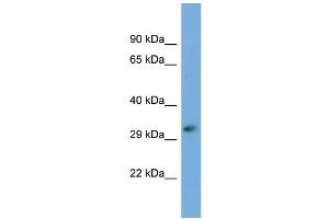 Host:  Rabbit  Target Name:  FKTN  Sample Type:  721_B Whole cell lysates  Antibody Dilution:  1. (Fukutin anticorps  (C-Term))