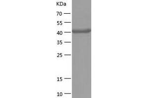 Western Blotting (WB) image for Aminoacylase 1 (ACY1) (AA 1-408) protein (His-IF2DI Tag) (ABIN7121810)