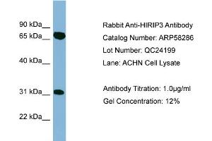 WB Suggested Anti-HIRIP3  Antibody Titration: 0. (HIRIP3 anticorps  (Middle Region))