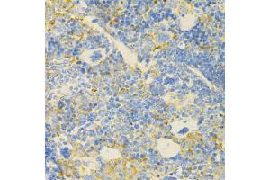 Immunohistochemistry of paraffin-embedded mouse spleen using GPX4 Antibody (ABIN5970997) at dilution of 1/200 (40x lens). (GPX4 anticorps)